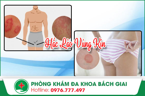 hắc lào vùng kín