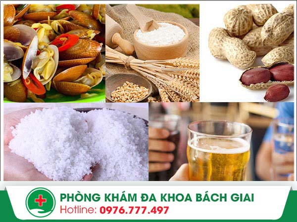 Bệnh chàm nên kiêng ăn gì? Bạn đã biết chưa?