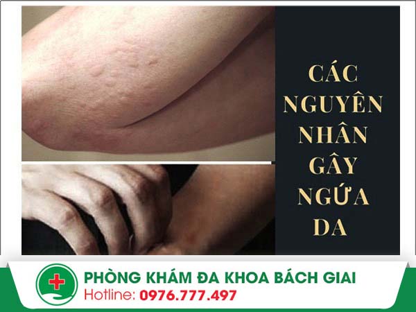 Nguyên nhân nào gây nên tình trạng ngứa da?