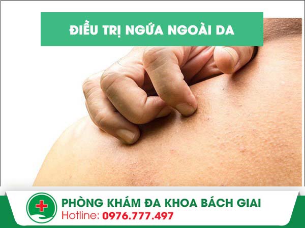 Các bệnh về da gây ngứa bạn đã biết?