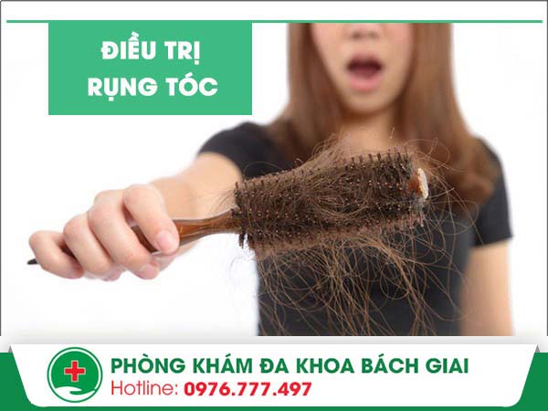 Mách bạn địa chỉ điều trị rụng tóc uy tín, chất lượng tại Hà Nội