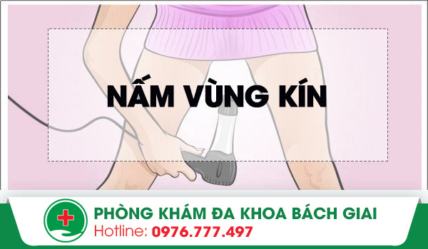 Bị nấm ở vùng kín – Không nên xem thường!