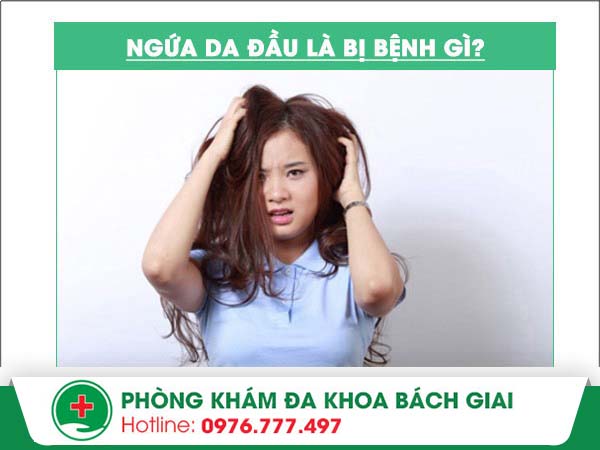 Ngứa da đầu nỗi “ám ảnh” của nhiều người