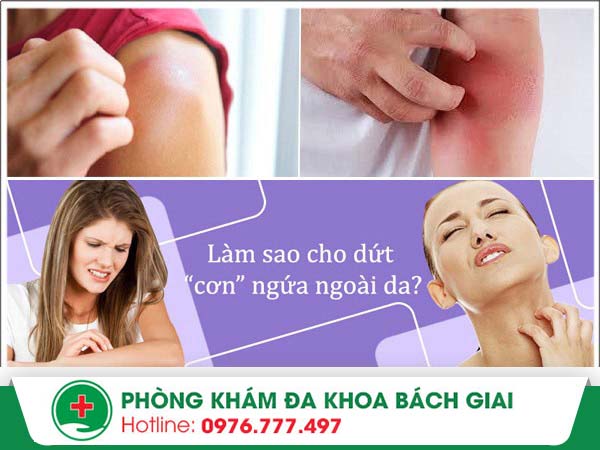 Ngứa ngoài da – Dấu hiệu “cảnh báo” nhiều vấn đề da liễu nghiêm trọng