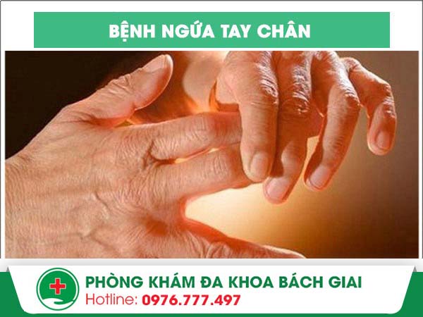 Ngứa tay chân – Nỗi “ám ảnh” này do đâu gây ra?