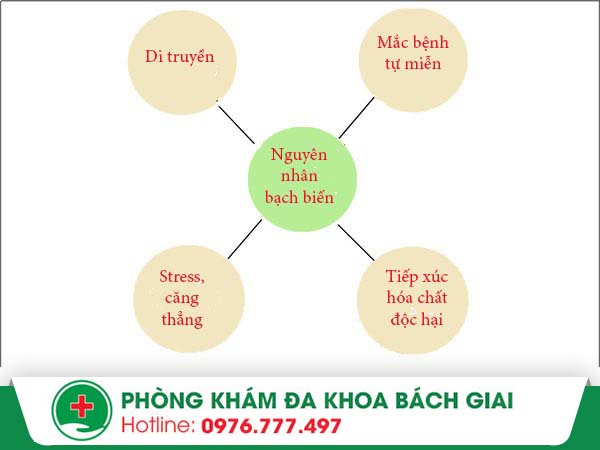 Nguyên nhân nào gây ra căn bệnh bạch biến?