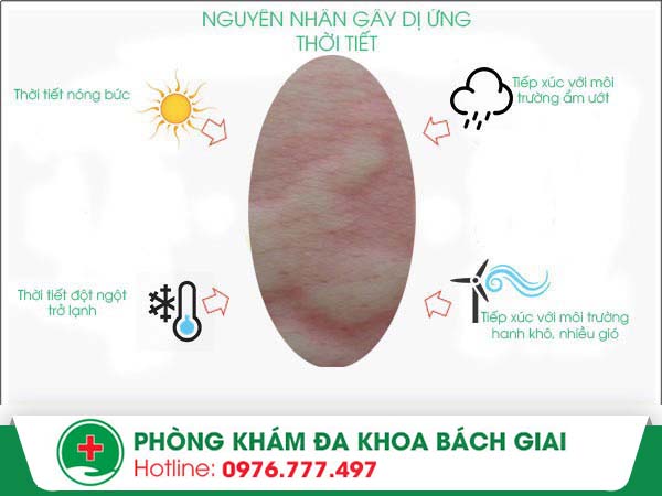 Nguyên nhân gây dị ứng thời tiết