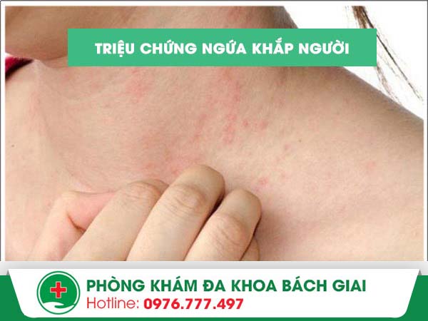 Triệu chứng ngứa toàn thân là biểu hiện của bệnh gì?